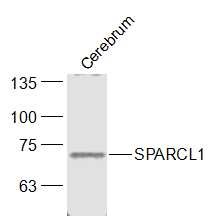 Anti-SPARCL1 Polyclonal Antibody