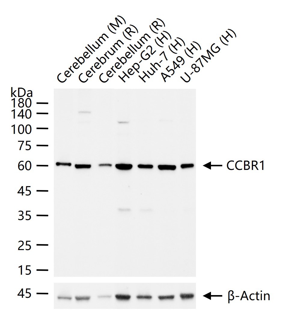 Anti-SLC7A11 Antibody (2U673)