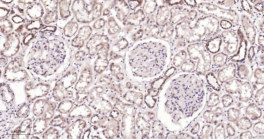 Anti-SIRT3 Polyclonal Antibody 2