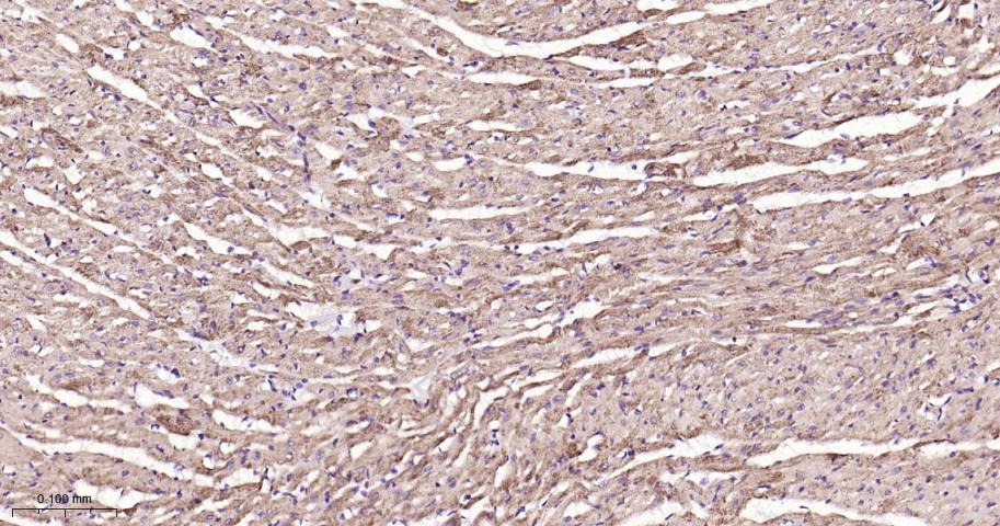 Anti-SIRT3 Polyclonal Antibody 2
