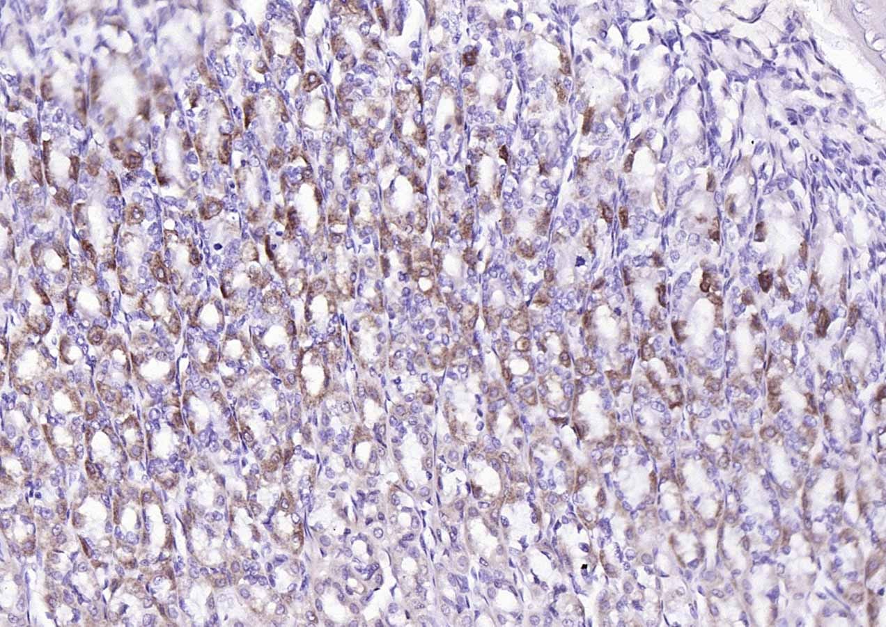 Anti-SIRT3 Polyclonal Antibody 2