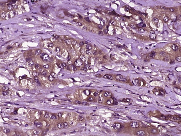 Anti-SLC5A1 Polyclonal Antibody