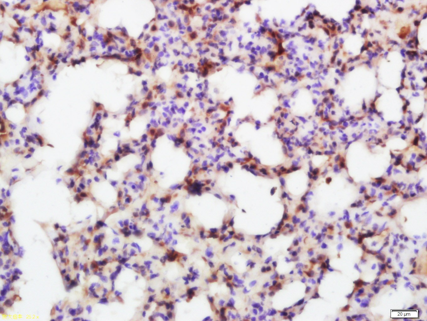 Anti-SMAD7 Polyclonal Antibody