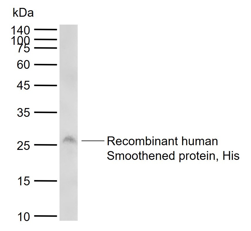 Anti-SMO Polyclonal Antibody