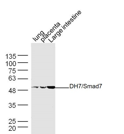 Anti-SMAD7 Polyclonal Antibody