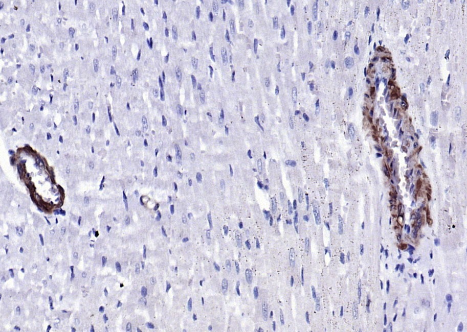Anti-SM22 Alpha Polyclonal Antibody
