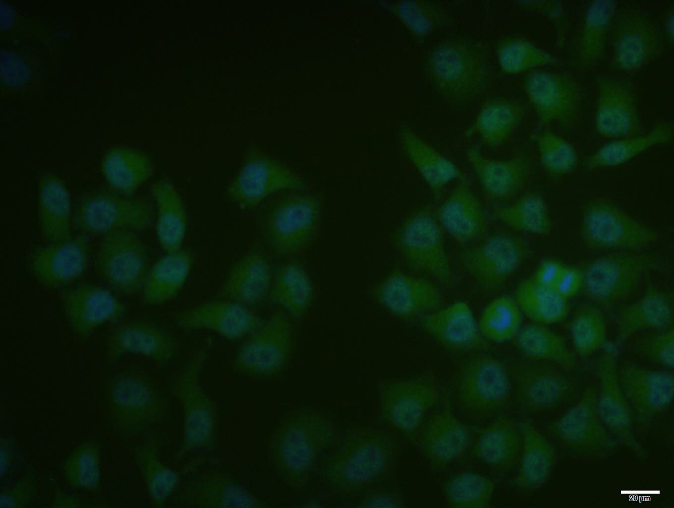Anti-SMAD1/SMAD5 Polyclonal Antibody