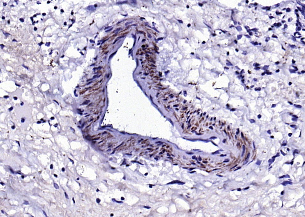Anti-SM22 Alpha Polyclonal Antibody