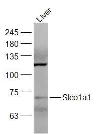 Anti-SLCO1A1 Polyclonal Antibody