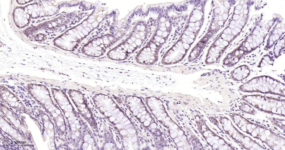 Anti-SMAD4 Antibody (1D720)