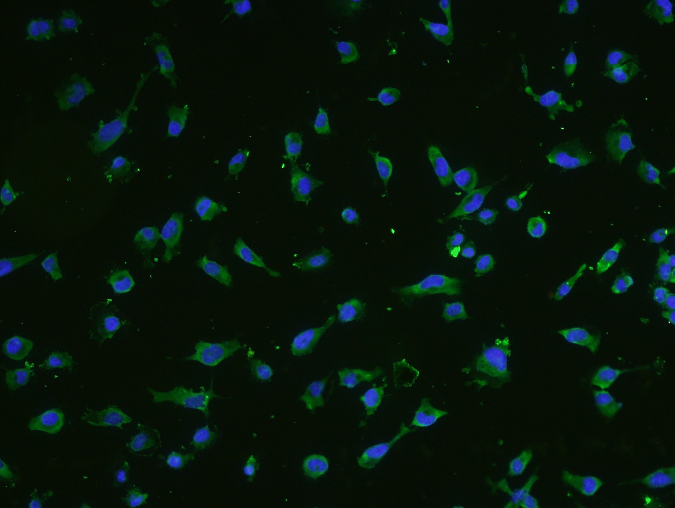 Anti-SM22 Alpha Polyclonal Antibody