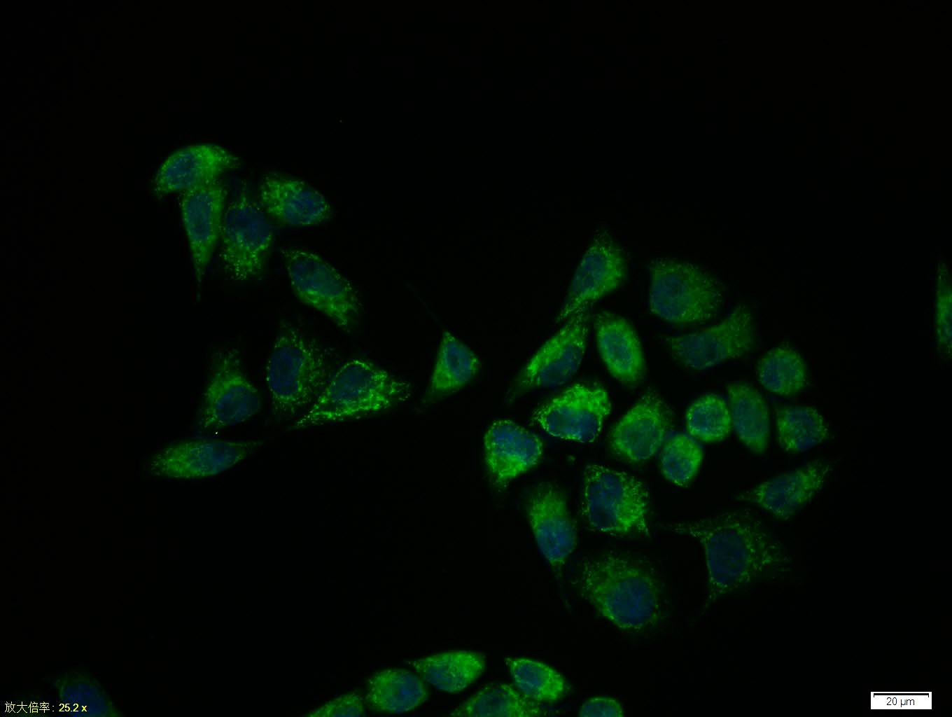 Anti-SMAD3 Polyclonal Antibody