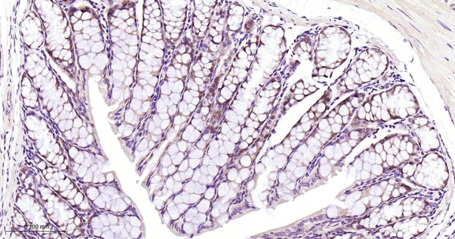 Anti-SMAD4 Antibody (1D720)