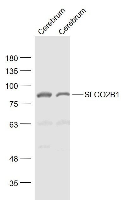 Anti-SLCO2B1 Polyclonal Antibody
