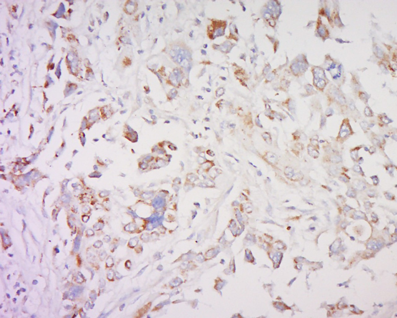 Anti-SMAD1 Polyclonal Antibody