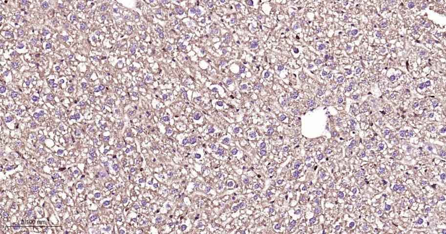 Anti-SMAD3 Antibody (8P334)