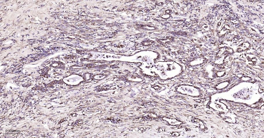 Anti-SMAD3 Antibody (8P334)
