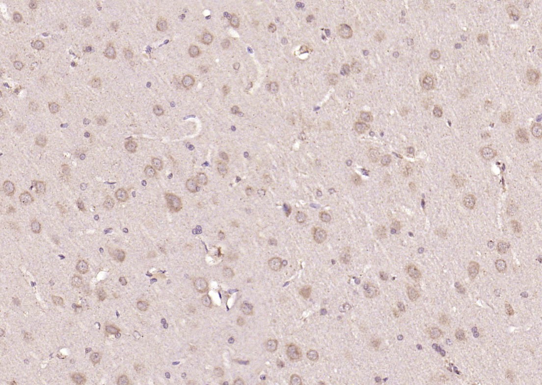 Anti-SMAD2 Polyclonal Antibody