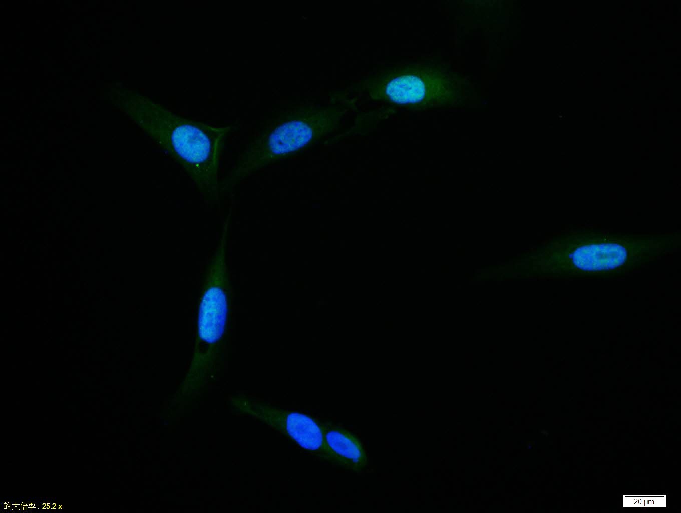 Anti-SMAD7 Polyclonal Antibody