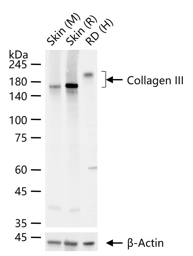 Anti-Collagen III/COL3A1 Polyclonal Antibody