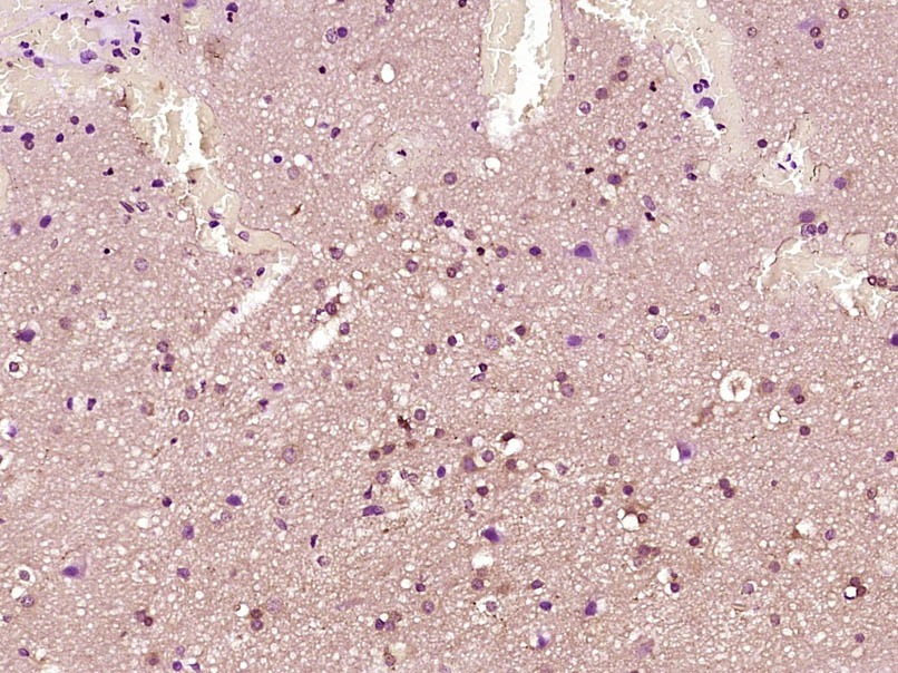 Anti-CEBP beta Polyclonal Antibody