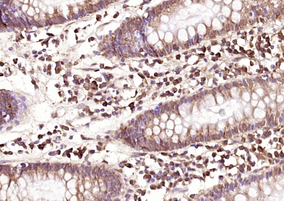 Anti-CEACAM8 Polyclonal Antibody