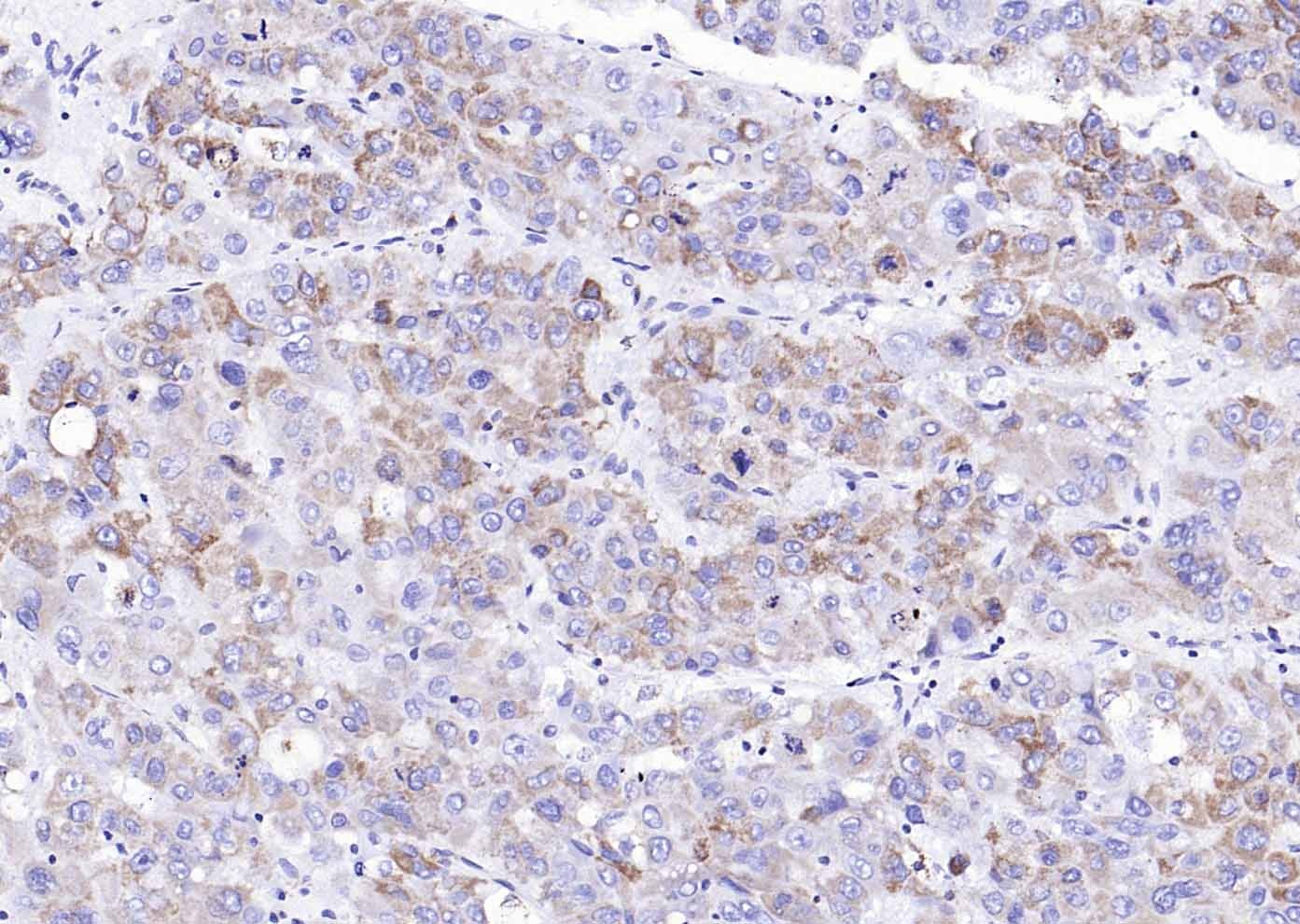 Anti-Collagen II/COL2A1 Antibody (7X334)