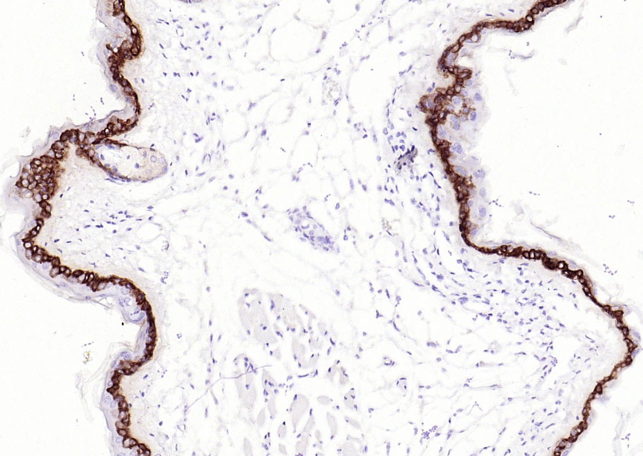 Anti-Collagen XVII/COL17A1 Antibody (3R637)
