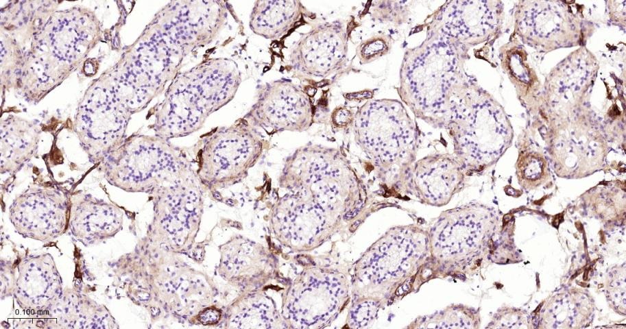 Anti-Collagen III/COL3A1 Polyclonal Antibody