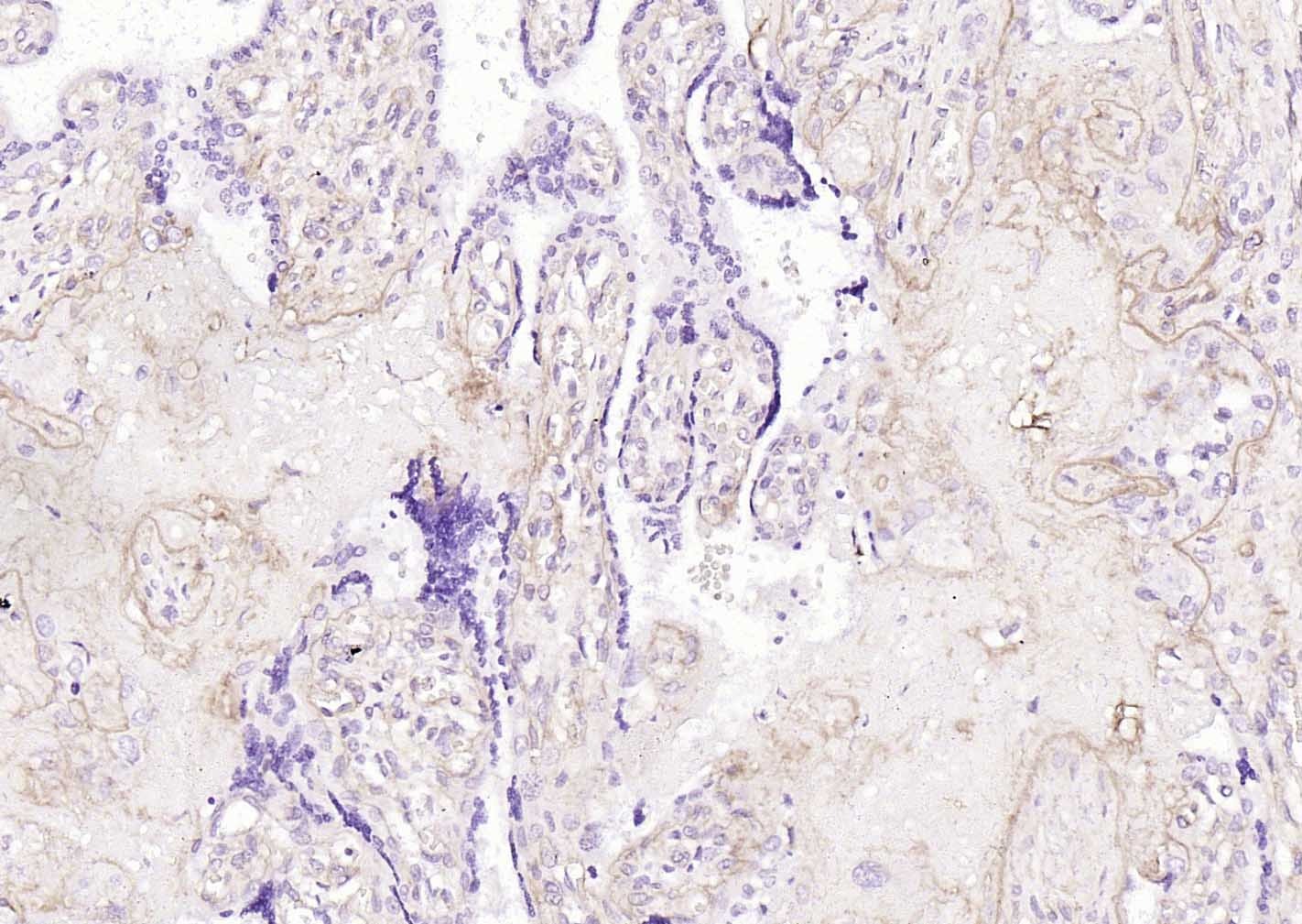 Anti-Collagen IV/COL4A1 Polyclonal Antibody 2