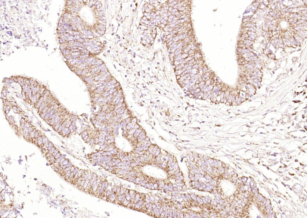Anti-CEACAM8 Polyclonal Antibody