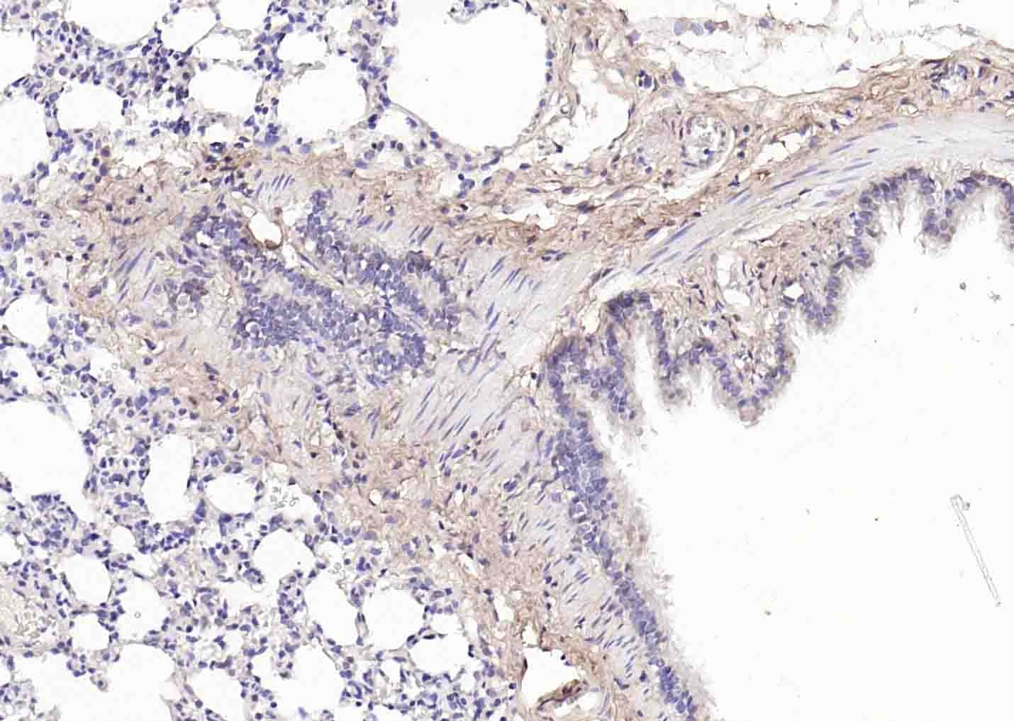 Anti-Collagen II/COL2A1 Antibody (7X334)