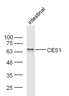 Anti-CES1 Polyclonal Antibody