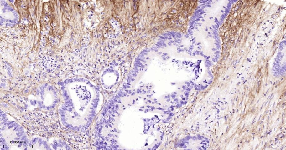 Anti-Collagen III/COL3A1 Polyclonal Antibody