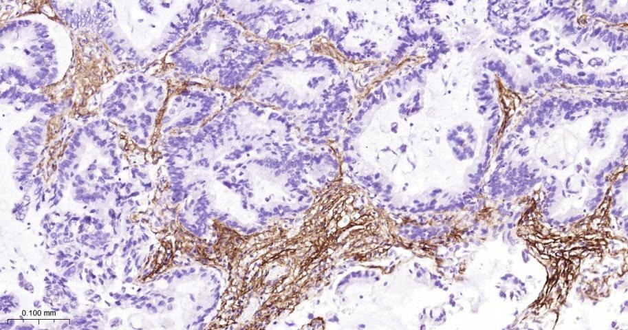 Anti-Collagen III/COL3A1 Polyclonal Antibody