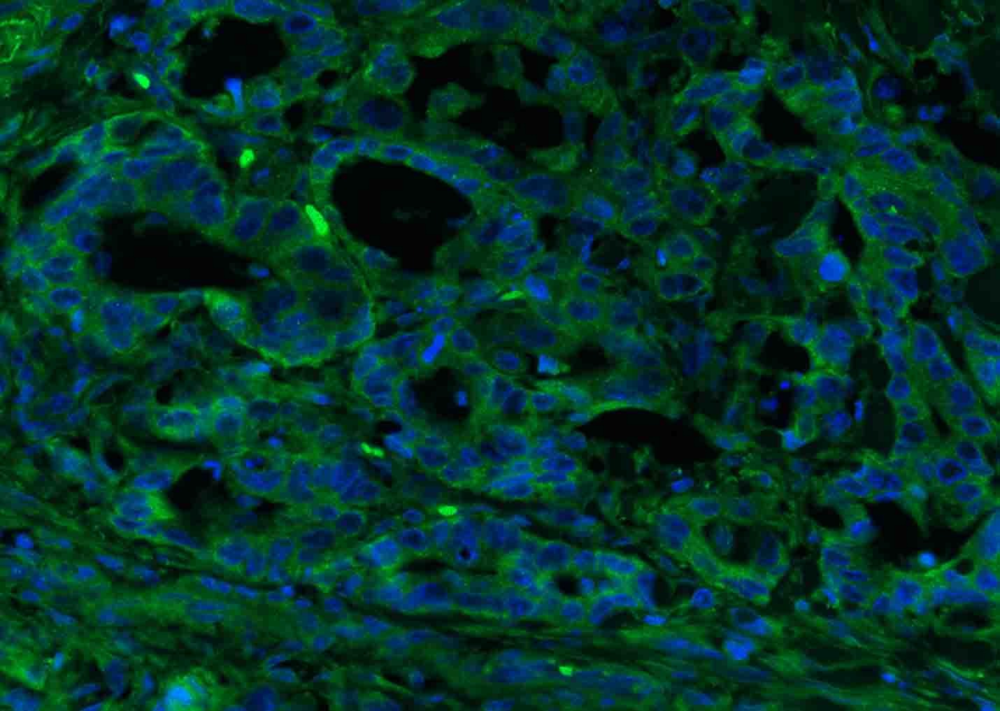 Anti-CEACAM5 Polyclonal Antibody 2
