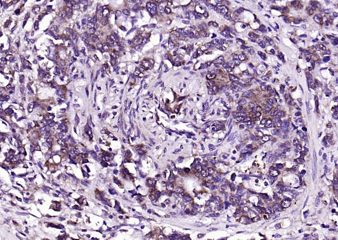 Anti-CEACAM5 Polyclonal Antibody 2