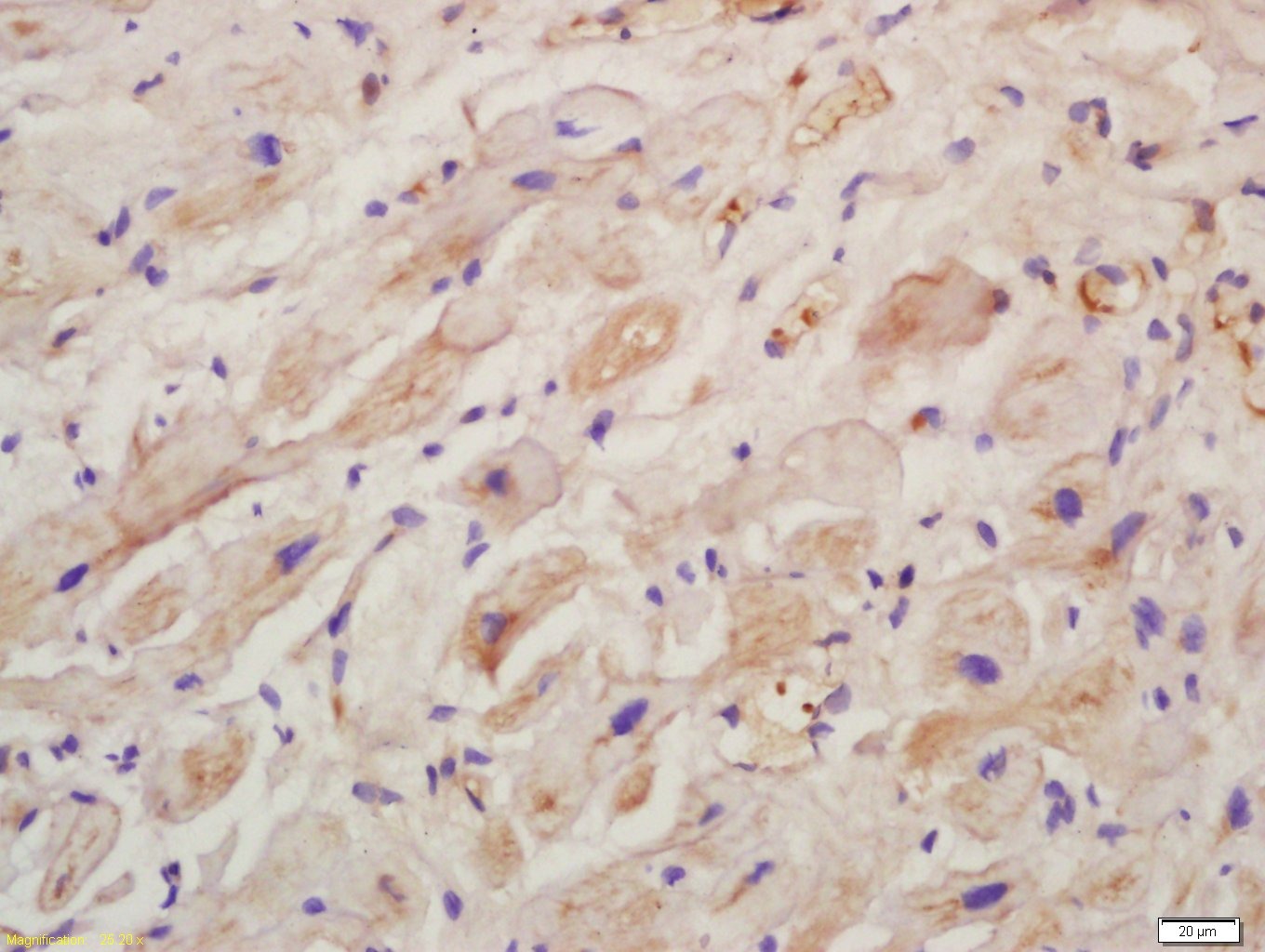 Anti-Collagen X/COL10A1 Polyclonal Antibody