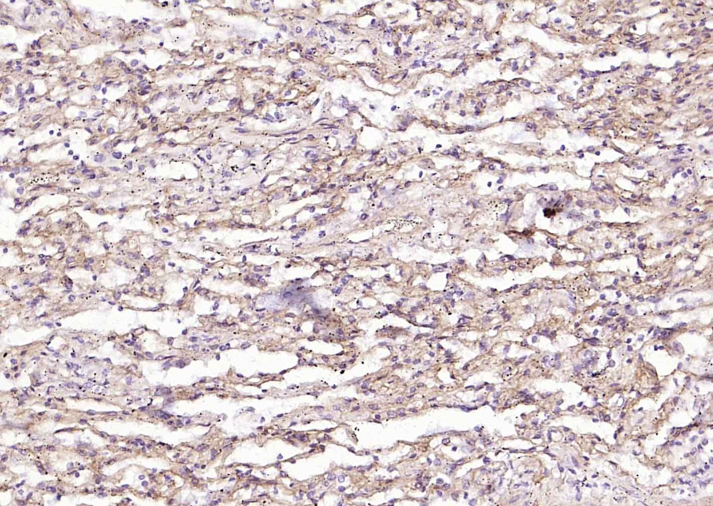 Anti-Collagen IV/COL4A1 Polyclonal Antibody 2