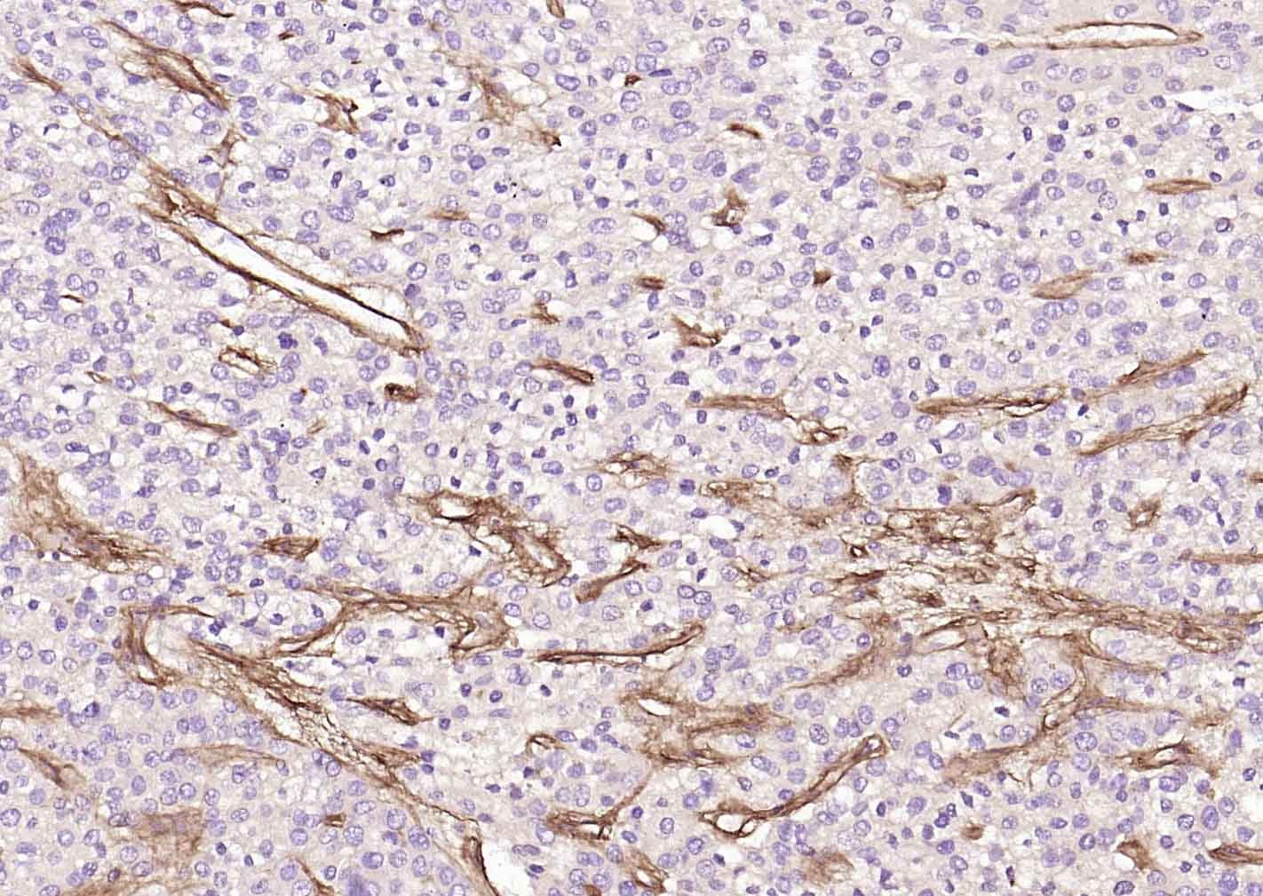 Anti-Collagen IV/COL4A1 Polyclonal Antibody 2