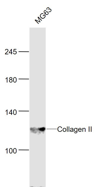 Anti-Collagen II/COL2A1 Polyclonal Antibody 2