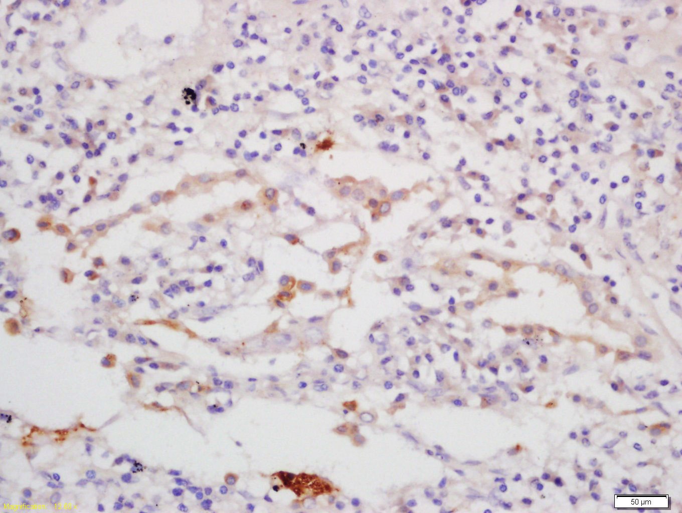 Anti-CGAS Polyclonal Antibody