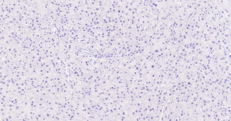 Anti-Collagen XVII/COL17A1 Antibody (3R637)