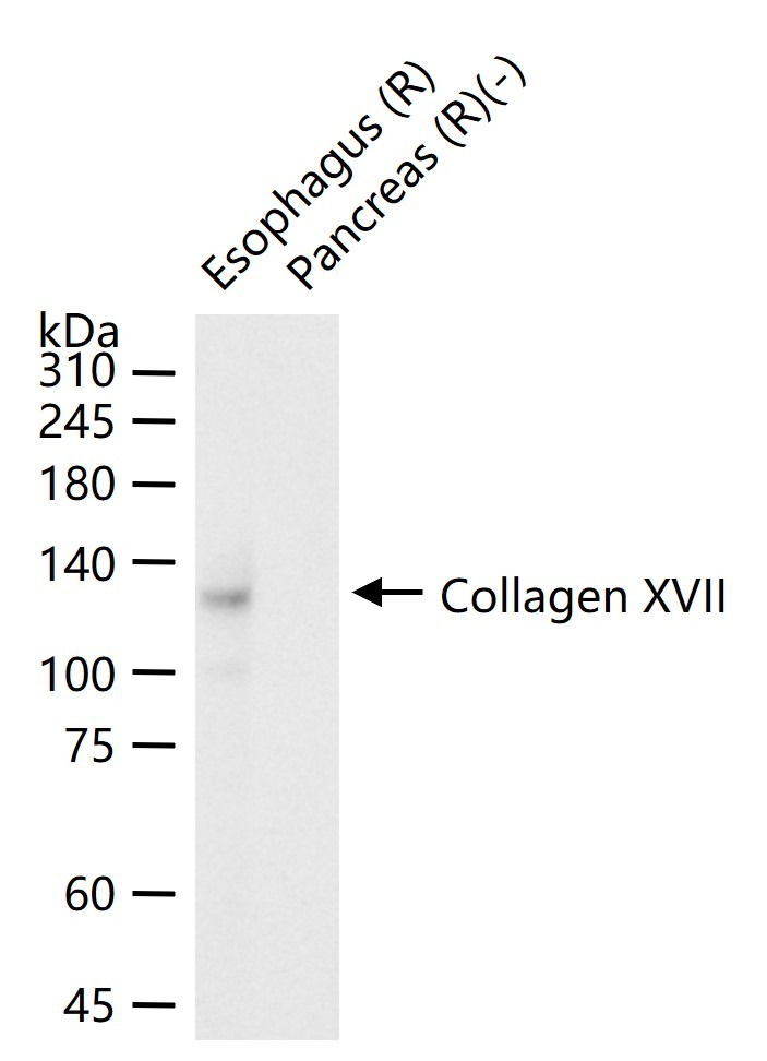 Anti-Collagen XVII/COL17A1 Antibody (3R637)