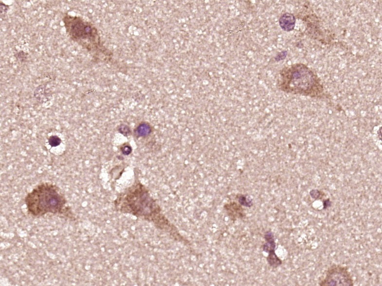 Anti-HK2 Polyclonal Antibody