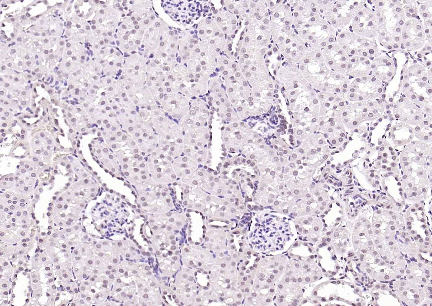 Anti-HMGB1 Polyclonal Antibody 2