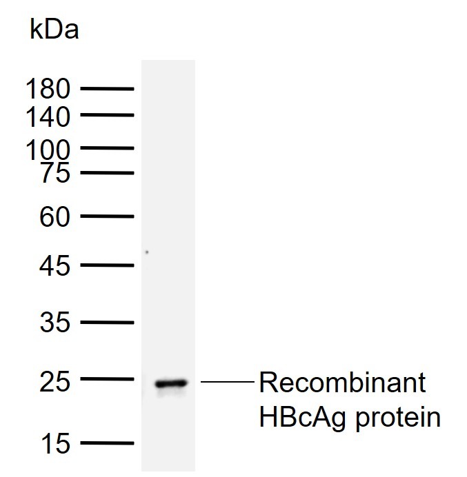 Anti-HBcAg Antibody (8B750)