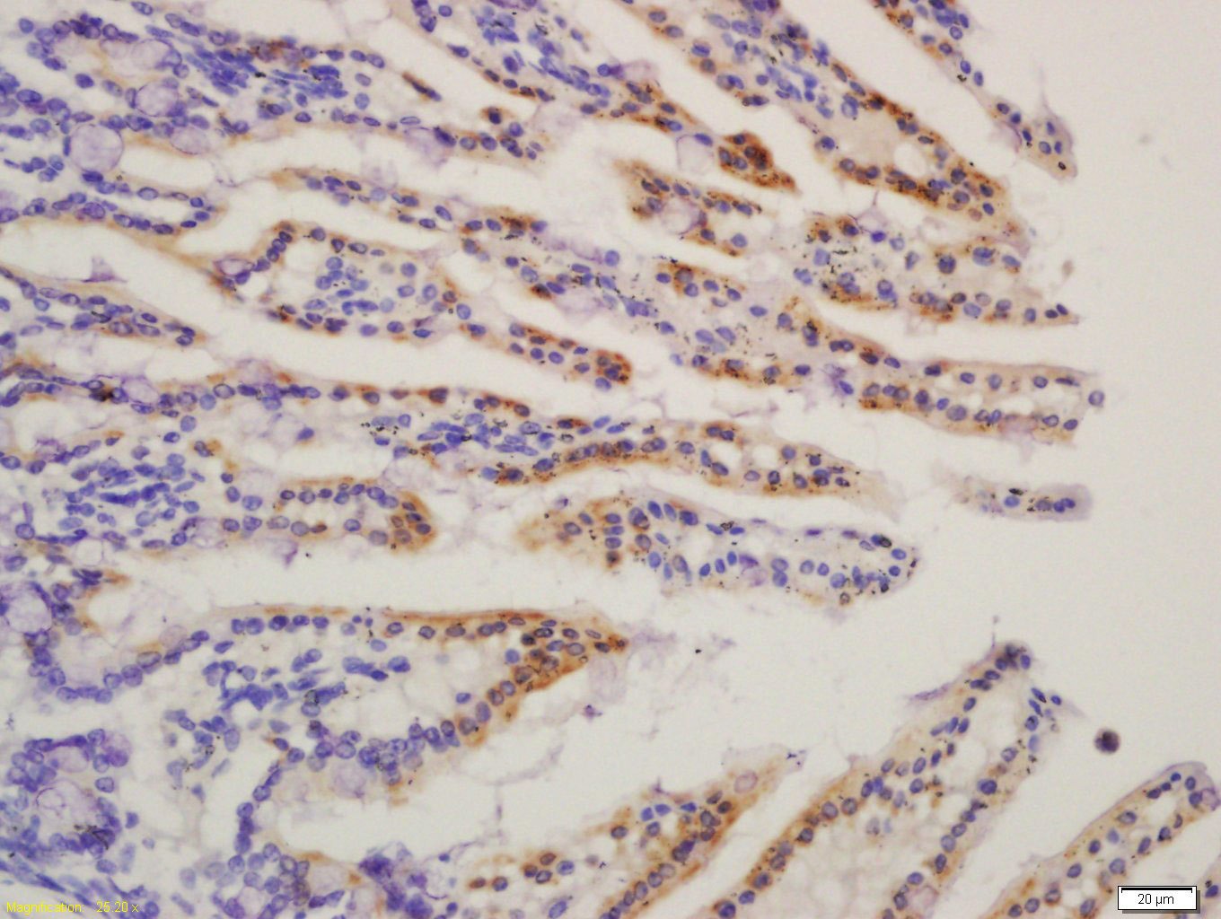 Anti-HMGCS2 Polyclonal Antibody
