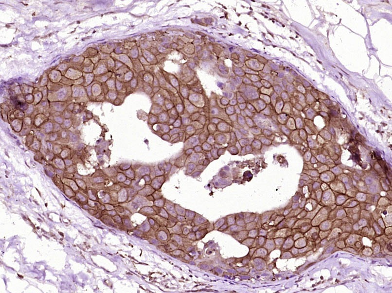 Anti-HER2/ERBB2 Antibody (3F246)