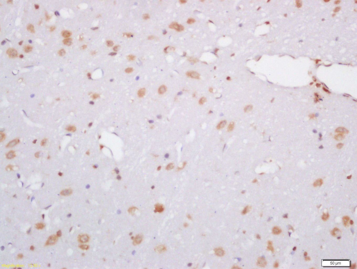 Anti-hydroxyproline Polyclonal Antibody